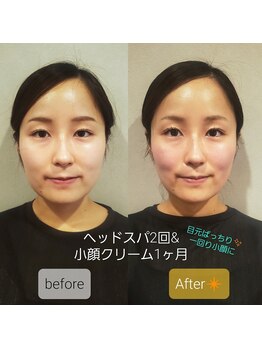 プリマ(prima)/当店のヘッドスパの実力