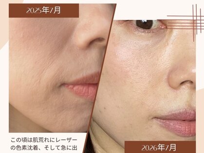 ブルーム(BLOOM)の写真