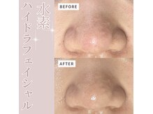 ベル(Belle)の雰囲気（角栓一つ残さない丁寧な施術ならお任せ下さい！）