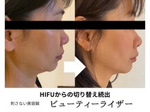 トータルビューティーサロンリア(Li'a)
