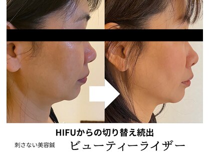 トータルビューティーサロンリア(Li'a)の写真