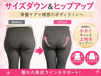 ソワレ(soiree)の写真/【痩身モニター募集】サイズダウンとフェムケアで悩みを解消！骨盤ケアで腰痛・便秘・生理不調もサポート◎