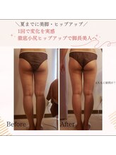 プライベートサロン 美月/1回でヒップアップ＆美脚