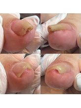 ウェルズユキ(well's yuki)/