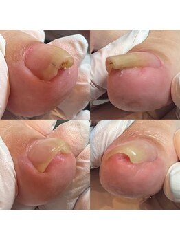 ウェルズユキ(well's yuki)/