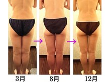 バービーホリック(barbie holic)/痩身　途中経過の変化　４０代