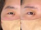 ミファ(mihwa)の写真/アイブロウ×フェイシャルWAXの同時施術可能！メイクノリや肌トーンもUP♪誰もが憧れるお肌に◎