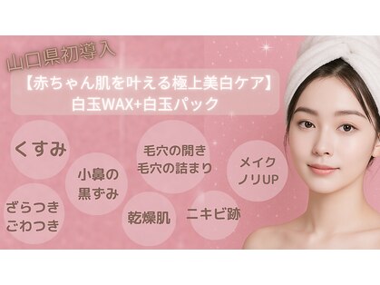 プラセル(PLACER)の写真