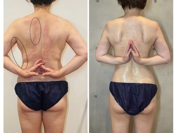 ロータス(Lotus)の写真/本気のサイズダウンを、恵比寿のプライベートサロンで叶える！痩身はLotusにお任せください♪　痩身/エステ