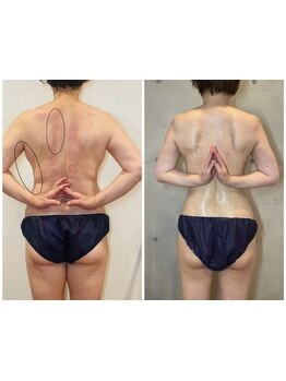 サイズダウンを目指したい