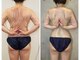 ロータス(Lotus)の写真/本気のサイズダウンを、恵比寿のプライベートサロンで叶える！痩身はLotusにお任せください♪　痩身/エステ