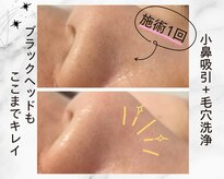 アイリー(iley)