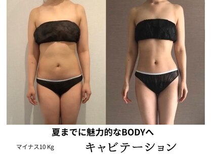トータルビューティーサロンリア(Li'a)の写真