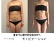 トータルビューティーサロンリア(Li'a)の写真