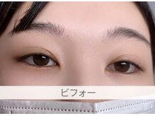 シロイトビラ 熊本銀座通り(SHIROI TOBIRA)/ビフォー