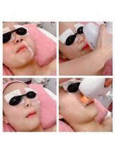 スパフランコルシャン(Spa Francorchamps)/お顔脱毛(鼻下）こだわり施術