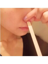 エミュー(Emyu)/【Wax脱毛】VIO+鼻+脇