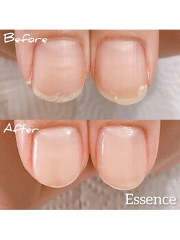 エッセンス (Essence)/自爪育成ケアを繰り返し育成◎