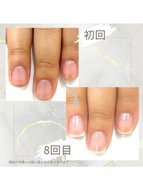 最強ネイルケア