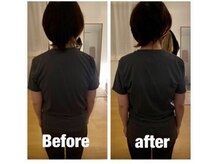 トトノウ 自由が丘店(totonou)/Before after (20)