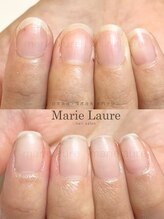 マリーロール 淀屋橋本店(Marie Laure)/自爪育成/深爪矯正/ネイルケア