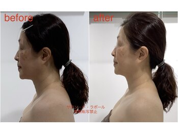 サロン ド ラポール/魅惑の小顔コルギ＆美姿勢調整