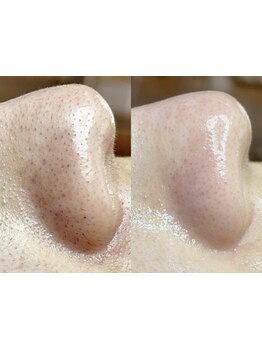 1回ごとにお支払い可能なサロン