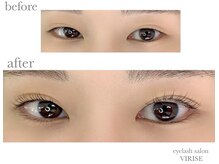 ヴィライズ 船橋(VIRISE)/before→after