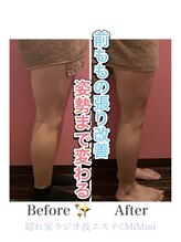 ミムー/before／after