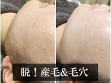 ヴィセル(VISEL)の雰囲気（【終わりある脱毛】全顔しっかり照射！脱毛/顔脱毛/毛穴/産毛）