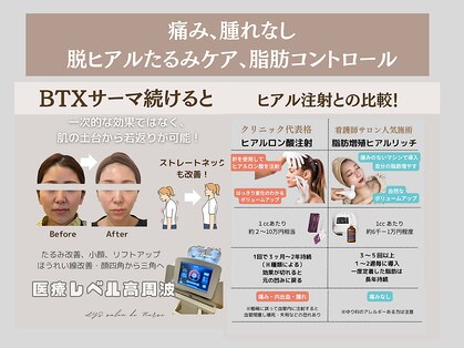 リス(LYS)の写真