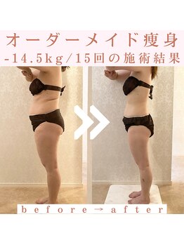 トータルビューティージュネス(JEUNESSE)/オーダーメイド痩身/健康美