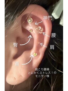 プララ(Plala)/疲労・肩こり・腰痛・ストレス