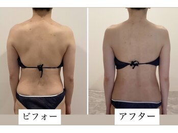 TMサロン 赤坂/首肩もっこり背中ガチガチ解放！