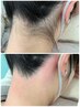 イベント◎W脱毛の凄さが分かる【つるつる肌】うなじWAX＋うなじ脱毛￥4400