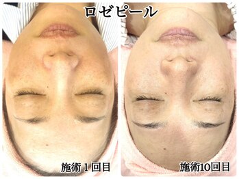 シルク(Cilk)/エイジングケアに特化！