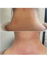 ラ ミジュ(La miige)/うなじWax