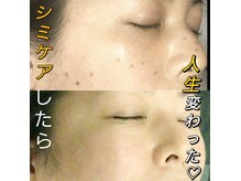 シェアキ(Chez Aki)の雰囲気（シミケアは是非、Chez Akiにお任せ下さい♪）