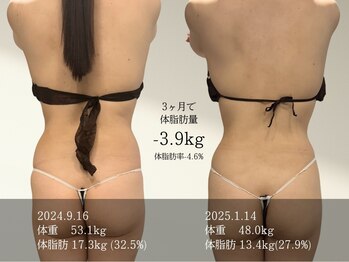 すらり/30代のお客様 / 担当:加藤 3ヶ月