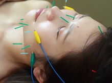 自然の恵み 鍼灸院/電気鍼で効果UP☆