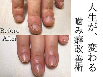 リュージェ(LEWJE)/噛み バイトネイル 自爪育成