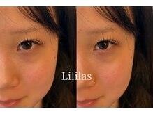 リリラース(Lililas)/