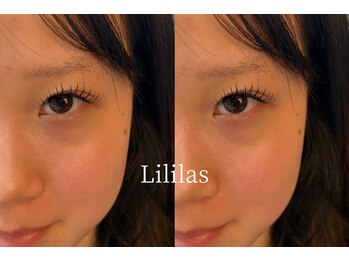 リリラース(Lililas)/
