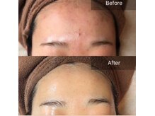 アリアサンティエ(Alia Scintiller)/オーダーメイドハーブ