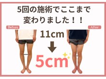 整体院がく 前橋駒形院の雰囲気（繰り返し施術を受けて頂くことで再発知らずの健康美脚に♪）