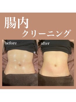 フラットベリー 恵比寿(Flat BELLY)/腸セラピー90分コース