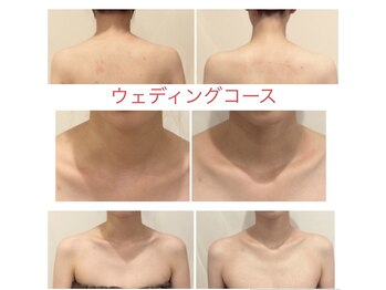 ミエル(Miel)/Before After