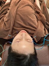 ハリファ鍼灸院 横浜関内院(HariFa鍼灸院)/美容施術