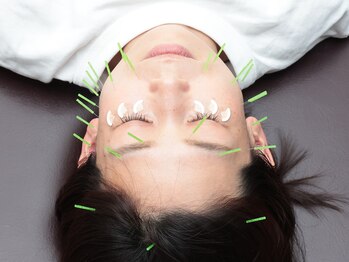 トラスト整骨院鍼灸院/筋肉やツボの位置を刺激!