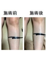 だるま整骨院/温熱マッサージの効果